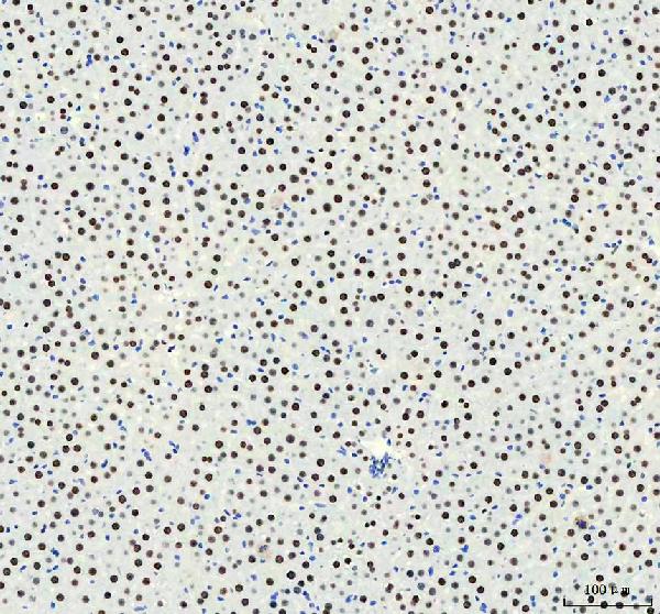 IHC - Anti-HNRNPM Rabbit Monoclonal Antibody ABO16441